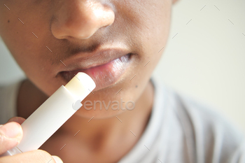 younger man making utilize of moisturising lip balm on lips