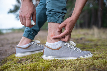 Unrecognizable man fingers put together balm to insect bites on ankle. Shield pores and pores and skin from eczema and allergic reaction